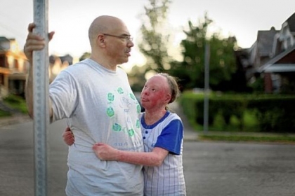 Hunter Steinitz hugs her father, Mark, outside their Brighton Heights home.